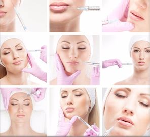 शिकन हटाने Hyaluronic एसिड भराव