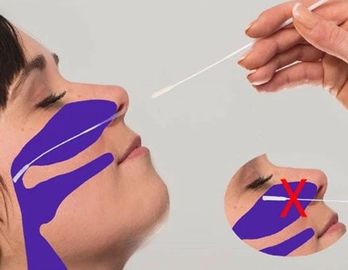 3 मिली एनपी फ्लॉक स्वैब